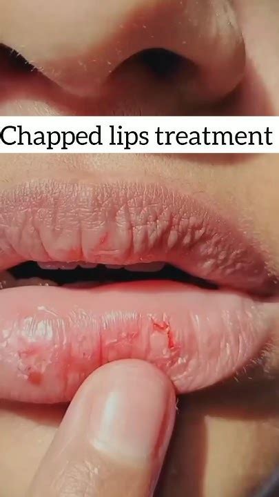 Kiss Goodbye To Chapped Lips💋say Hello To Smooth Lipbalm Beautytips