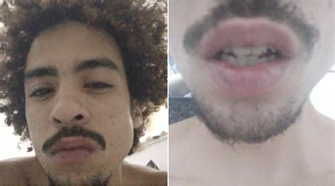 Jovem gay diz ter levado spray de pimenta ao tentar fazer denúncia em