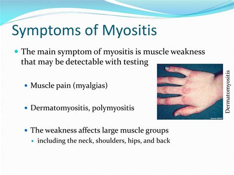 Ppt Microbiology Of Bone Joint Infections Powerpoint Presentation