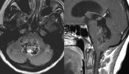 Question 26 MRI Online