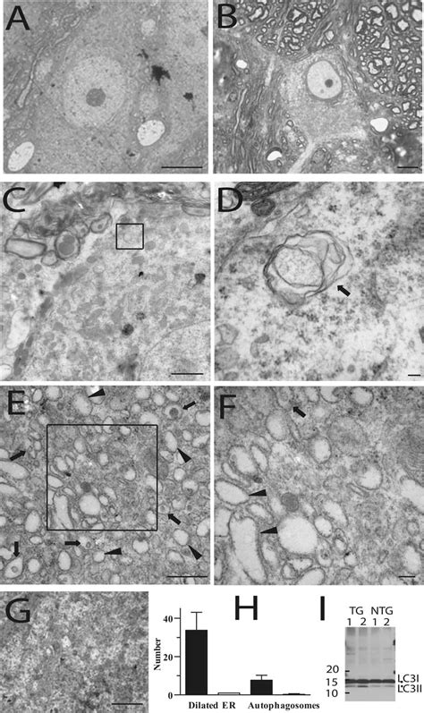 Figure 6 From Motor Neuron Disease Occurring In A Mutant Dynactin Mouse