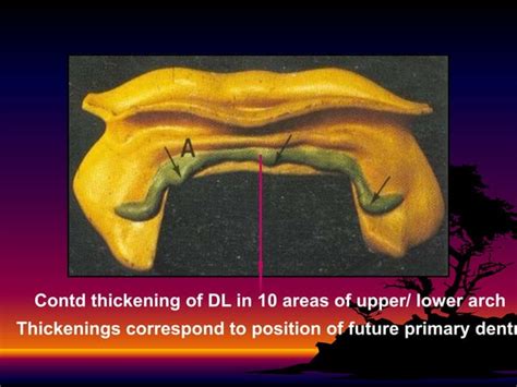 Development and morphology of primary teeth | PPT