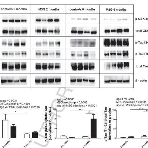 Msg Mice Show Age Related Pathological Tau Hyperphosphorylation In The