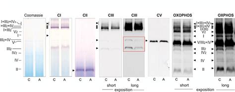 Blue Native Bn Page Showing Oxidative Phosphorylation Oxphos