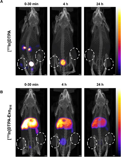 Whole Body Spect Ct Imaging Of Membrane Labelled B F Exosomes In