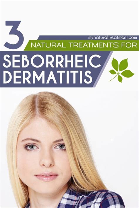 3 Amazing Natural Treatments for Seborrheic Dermatitis you should try # ...