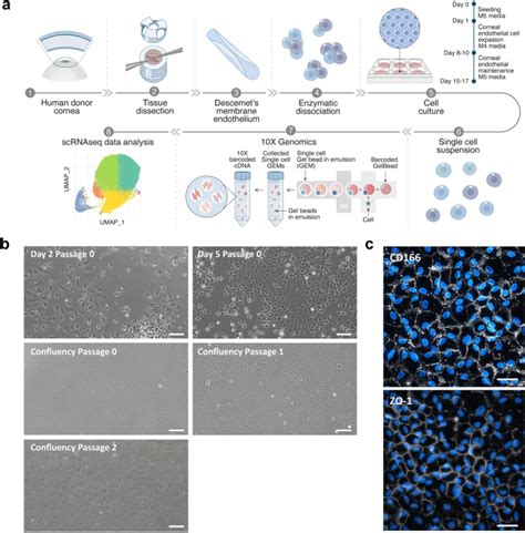 A Single Cell Rna Seq Analysis Unravels The Heterogeneity Of Primary