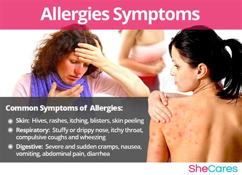 Signs Of Allergies In Adults