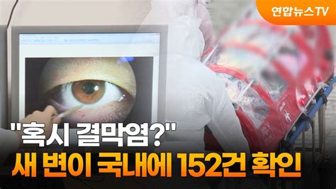 혹시 결막염새 코로나 변이 국내에 152건 확인 연합뉴스tv Yonhapnewstv Youtube