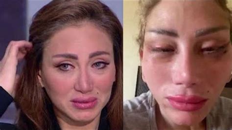 صور صادمة كيف تغير شكل ريهام سعيد بعد عملية التجميل؟ Youtube