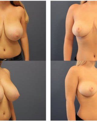 BIG BOOBS VS SMALL BOOBS Porn Pictures XXX Photos Sex Images PICTOA