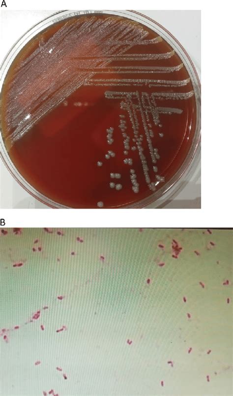 A Grayish Glistening Mucoid Colonies Of M Timonae On Blood Agar