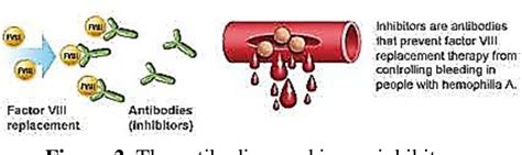 Treatment Of Haemophilia A By Replacement Therapy Using Factor Viii