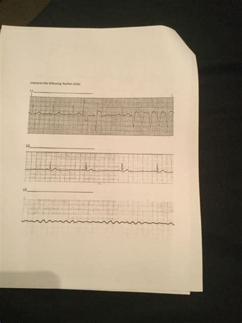 Solved Interpret The Following Rhythm Strips Chegg