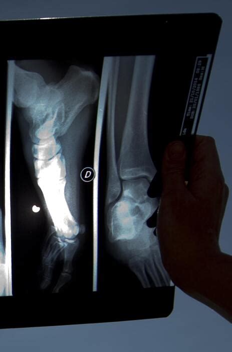 Pazienti Fotografate Nude Denunciato Tecnico Radiologo Notizie Ansa It