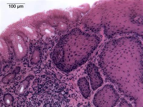 esophagus-stomach junction 10X – NPHistology