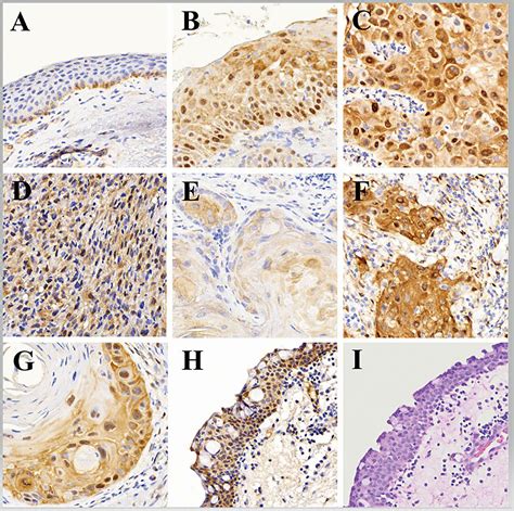 Frontiers Yes Associated Protein Overexpression In Ocular Surface