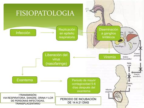 Enfermedades Eruptivas De La Infancia Ppt