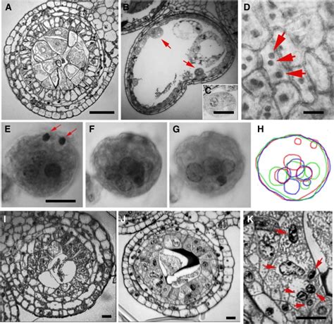 More defects in cell proliferation. (A) Additional anticlinal divisions ... 
