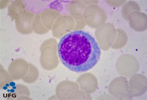 Atlas Hematologico Secuencia De Maduraci N Eritrocitaria