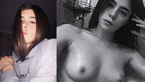 Another Collection Of Fresh Faced Before And Afters Vsco Fb Porn Pic