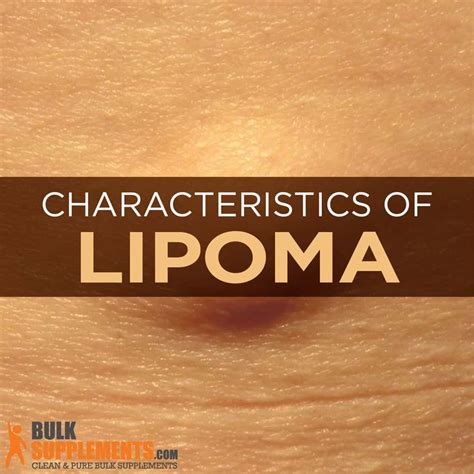 Lipoma: Characteristics, Causes & Treatment