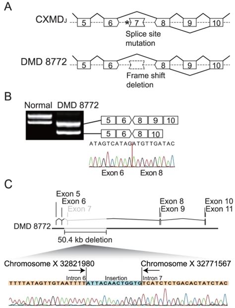 A Splice Site Mutation Of A Splice Acceptor Site In Intron 6