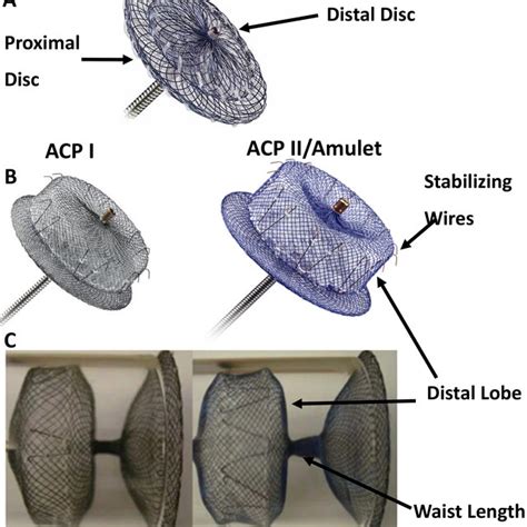 Pdf Percutaneous Left Atrial Appendage Occlusion Therapy Evolution