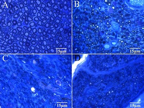 Histological Sections Of Regenerated Nerves Semithin Cross Sections Of