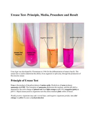 The Triple Sugar Iron Lab The Triple Sugar Iron Tsi Test