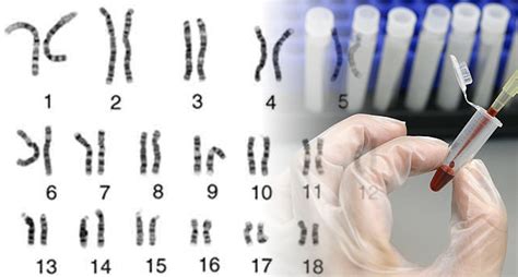 Prenatal DNA Test Accurately Detects Fetal Disorders - Guardian Liberty Voice