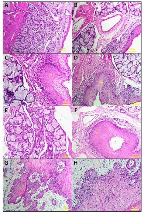 Oropharynx Histology