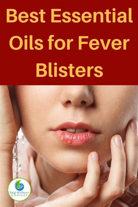 Top 5 Essential Oils For Fever Blisters Cold Sores Essential Oils For Fever Essential Oils