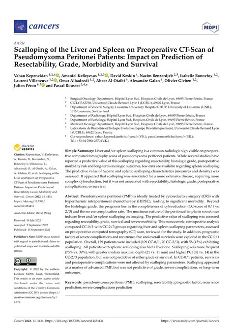 PDF Scalloping Of The Liver And Spleen On Preoperative CT Scan Of