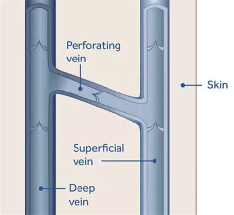 Brachial vein