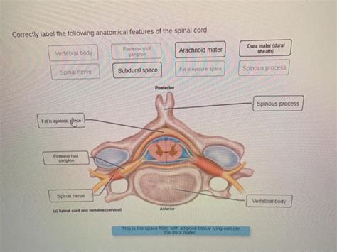 Correctly Label The Following Anatomical Features Of The Spinal Cord