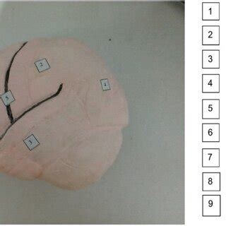 Modelo tridimensional del encéfalo Vista superolateral Download