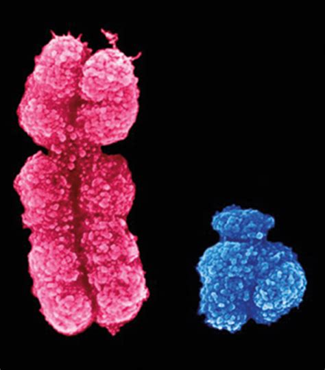 A Spotlight On Sex Differences In Neurological Disorders The Lancet