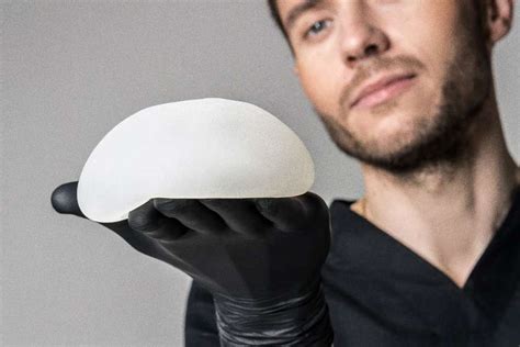 Do Breast Implants Have To Be Replaced When To Replace Breast