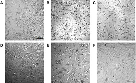 Frontiers Bacterial Mediated Synthesis And Characterization Of Copper