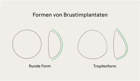 Brustvergr Erung In Freiburg Aesthemedica