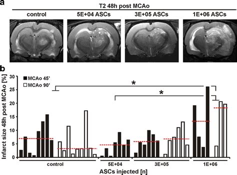 Mri Analysis Of Infarct Size H Post Mcao A Representative