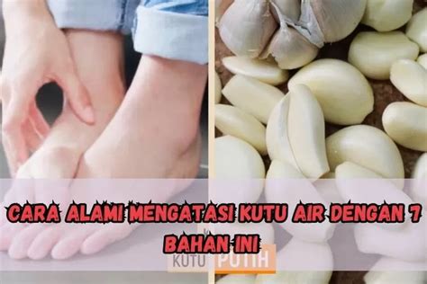 Sudah Pakai Beragam Salep Tapi Kakimu Masih Gatal Karena Kutu Air