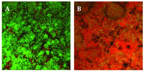 Confocal Laser Scanning Microscopy Clsm Of Multi Species Biofilms