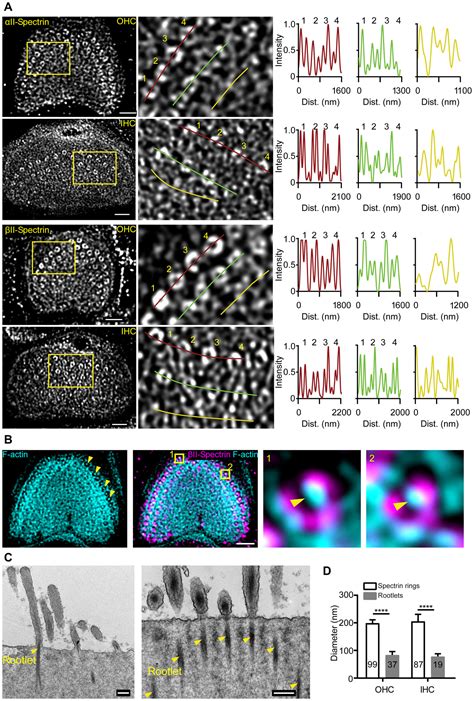 Critical Role Of Spectrin In Hearing Development And Deafness Science