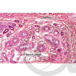 Man Sweat Gland Vertical Section X Sweat Gland Mammals