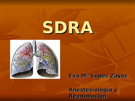 PPT SDRA Eva Mª López Zayas Anestesiología y Reanimación DOKUMEN TIPS