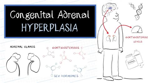 Congenital Adrenal Hyperplasia