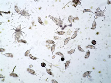 Freshwater Aquatic Plankton Under Microscope View Stock Image Image