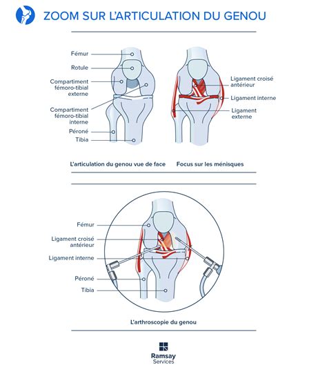 Le Ménisque Cette Zone Du Genou à Haut Risque De Lésions Et Déchirures
